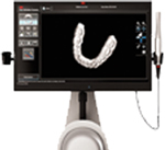 a Machine showing digital impressions of a set of teeth