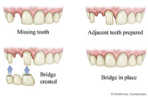 illustration of teeth conditions