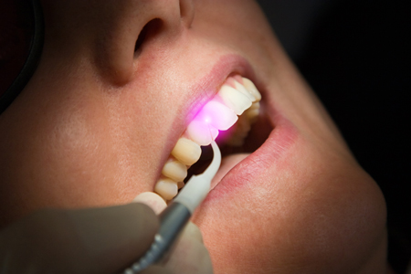 patient getting laser therapy for gums