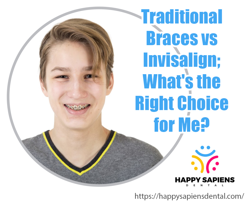 Traditional Braces vs Invisalign; What's the Right Choice for Me?