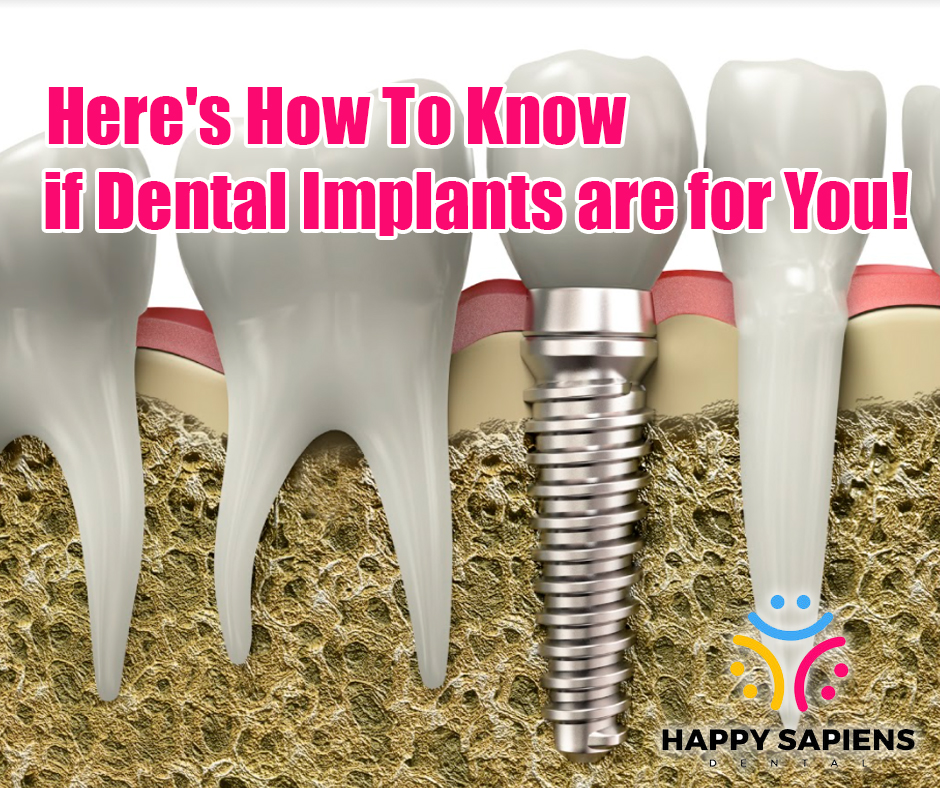 Here's How To Know if Dental Implants are for You!