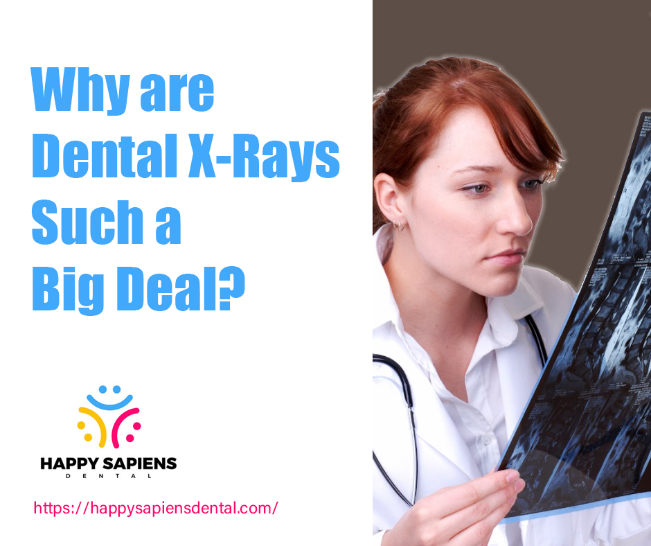 Why are Dental X-Rays Such a Big Deal?