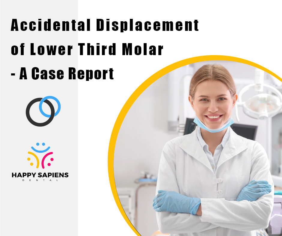 Accidental Displacement of Lower Third Molar - A Case Report