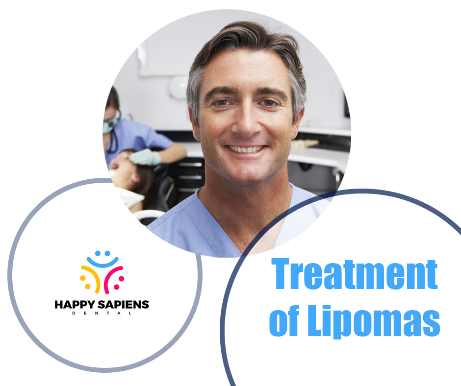 Treatment of Lipomas