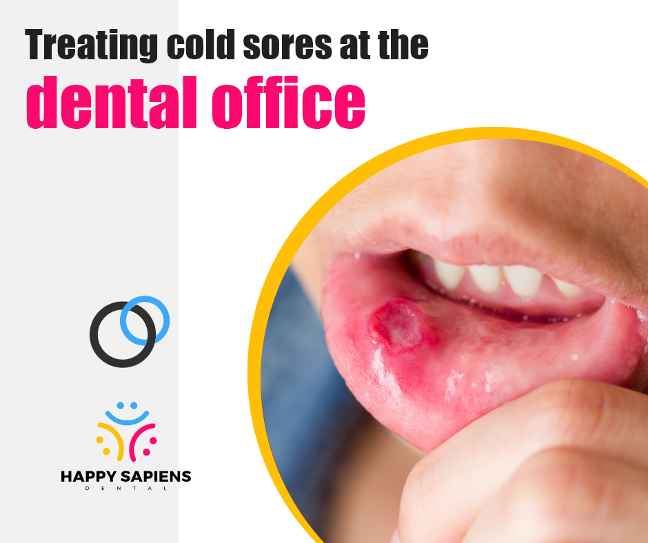 Treating cold sores at the dental office